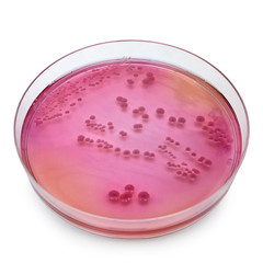 Petri dish with bacteria colonies
