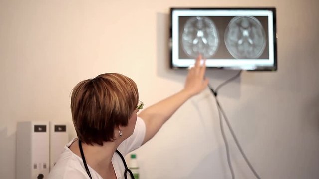 Eine junge &Auml;rztin erkl&auml;rt ihrer Patientin ihre Erkrankung