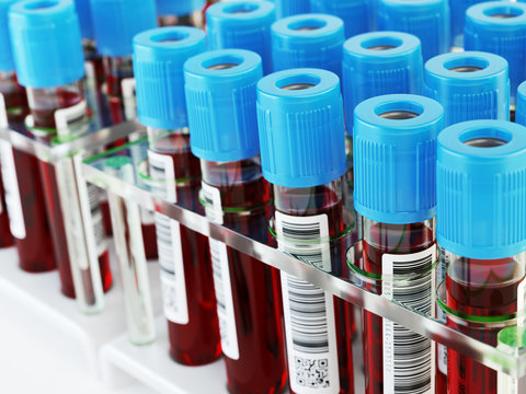 Blood test tubes. Blood samples in a rack.