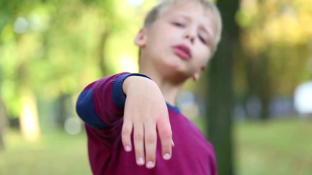 Child was bitten by bee on finger unexpectedly. Boy showing his hand over green nature background. Close up of fingers. Portrait of children face wet from tears looking at camera. Real time video.