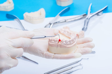 Fototapeta na wymiar Dentist examinates the teeth mold