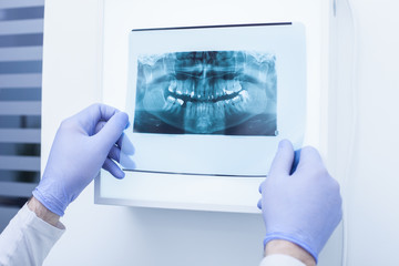 Male doctor holding and looking at dental x-ray