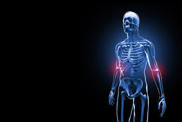 Painful elbows 3D illustration