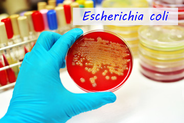 Colonies of Escherichia coli in petri dish