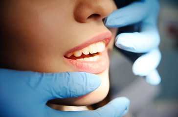 beautiful girl at the dentist. Dental fillings