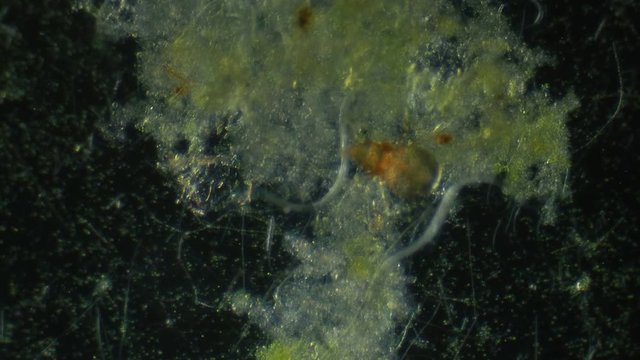 Nematode Worms Consuming Organic Matter Dark Field Microscope 100x
