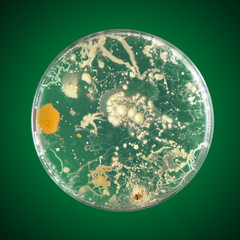 Bacteria growing in a petri dish
