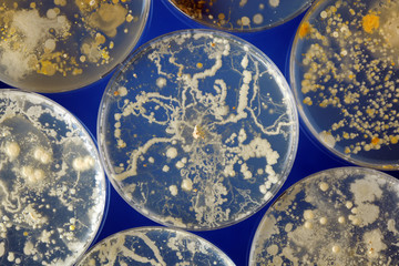 Bacteria growing in a petri dishes