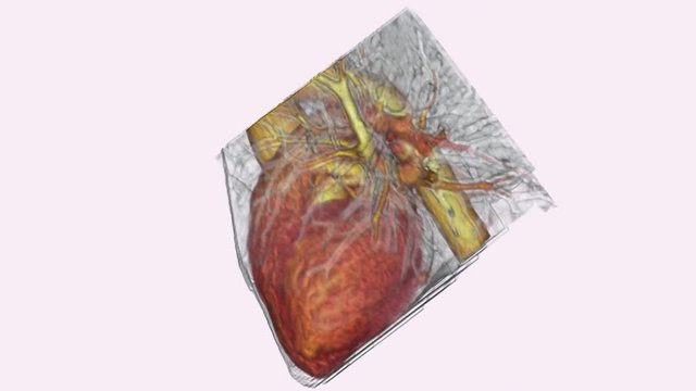 Beating human heart