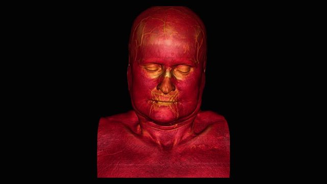 Reconstruction of head of elderly man