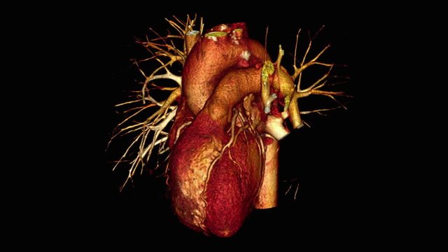 Left coronary artery