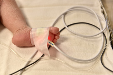 Newborn baby with cannula in the feet on a hospital bed
