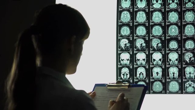 Female neurologist looking thoughtfully at brain x-ray, writing down diagnosis