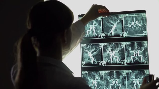 Neurosurgeon examining blood vessels x-ray, making diagnosis, patient treatment