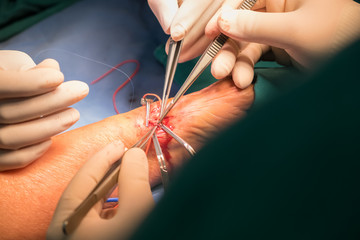 vascular surgery