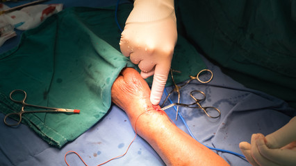 vascular surgery
