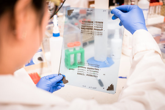 researcher working on gel results