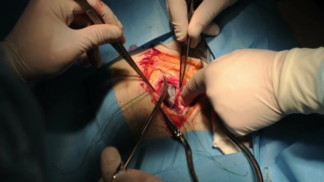 Doctor with assistant makes operation on leg