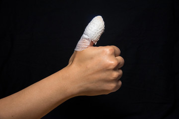 thumb with injured finger - 109490081