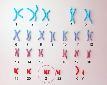 Down-syndrome karyotype, male, labeled. Trisomy 21. 3D illustration