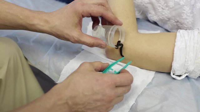 Doctor Establishes Medical Leeches