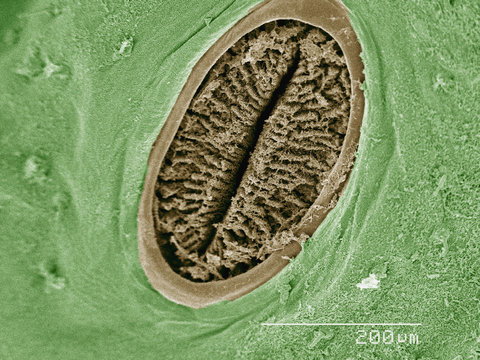 Coloured SEM of spiracle of hornworm (Sphingidae)
