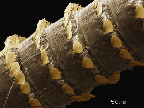 Coloured SEM of antenna of Plecoptera (Peltoperlidae)