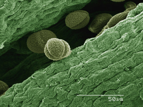 Coloured SEM of flower of false rue anemone (Enemion sp)