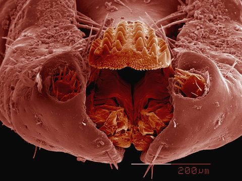 Coloured SEM of mouthparts of engorged female dog tick