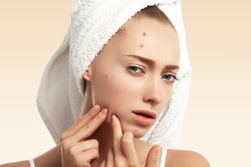 Close up isolated portrait of young woman squeezing pimple on her cheek in the bathroom. Cropped...