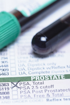 Studio shot of blood sample tube (containing synthetic blood) on a haematology requisition form listing prostate-specific antigen (PSA) test.