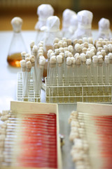 Microorganism tubes in medical ladoratory