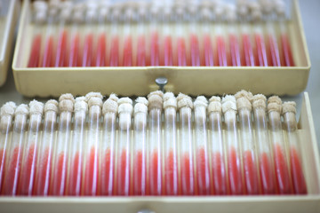 Bacteriological analysis in medical laboratory; plate with sterile tubes for microorganism...