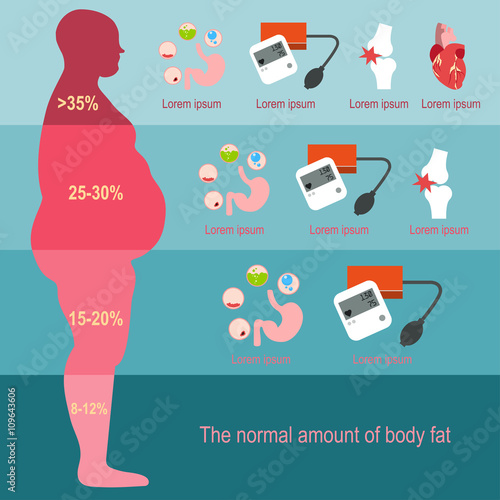 "Obesity man. The degree of obesity. Vector illustration. The