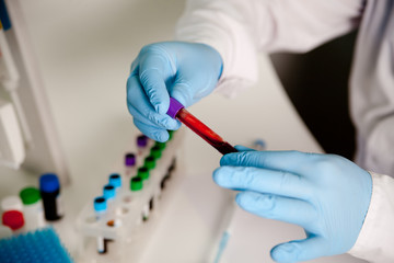 Scientific laboratory technician holding a tube of blood