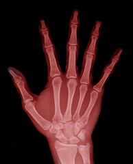 Human hand x-ray - Medical Image. red color
