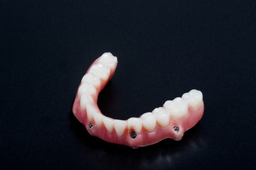 Hibrida prótesis dental sobre implantes  - 109790026