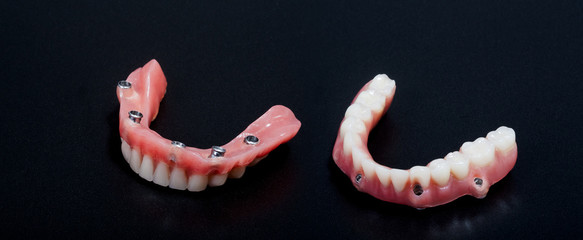 Híbrida pótesis dental sobre implantes  - 109790437