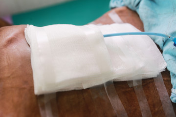 bandaging the abdomen surgical wound and drain