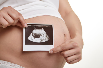 Close up of pregnant woman holding ultrasound scan on her tummy