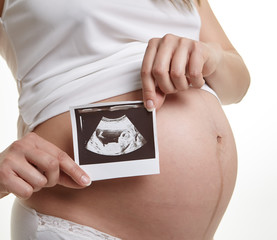 Close up of pregnant woman holding ultrasound scan on her tummy