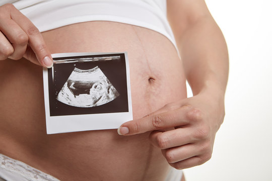 Close up of pregnant woman holding ultrasound scan on her tummy