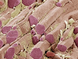 Skeletal muscle fibres, SEM