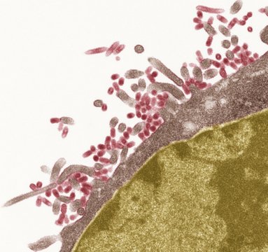 Influenza viruses, TEM