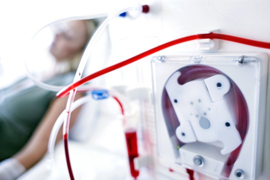 Kidney dialysis