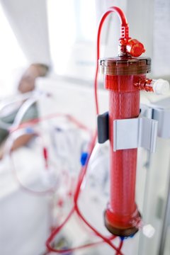 Kidney dialysis