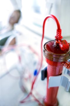 Kidney dialysis