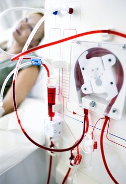 Kidney dialysis