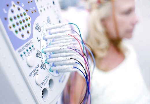 Electroencephalography