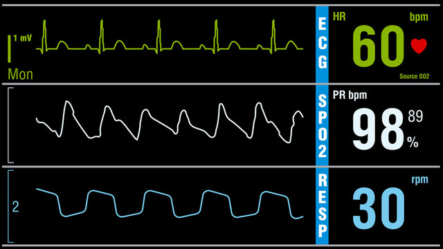 Patient monitor displays vital signs ECG electrocardiogram EKG, oxygen saturation SPO2 and respiration. Medical examination vector illustration.